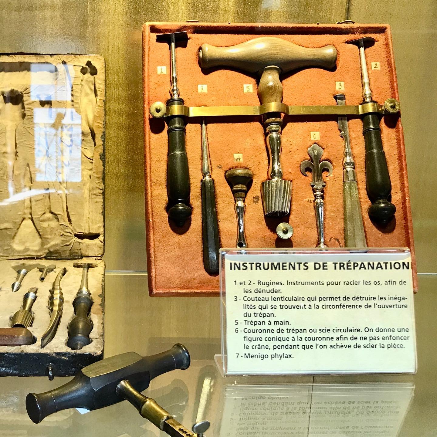 Paris-Museum-Medical-Instruments-Trepanation.jpg.jpg