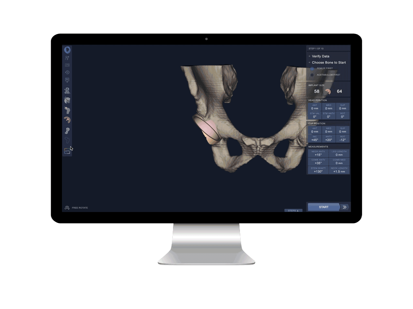 Hip-Planner---CT-Mode.gif