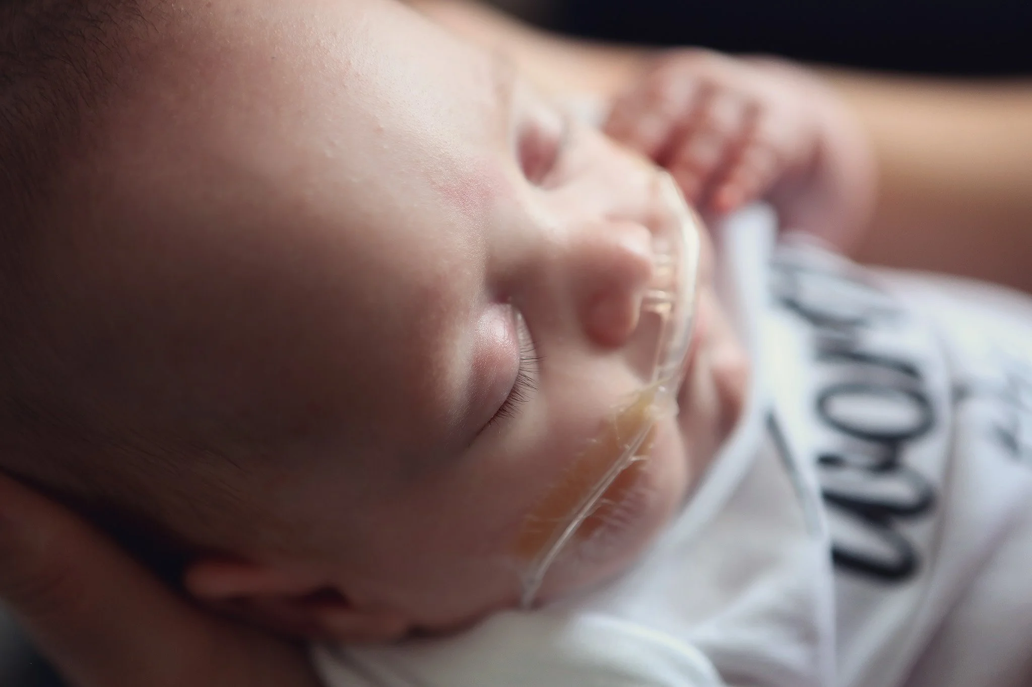 Close-up of a young child's face sleeping with a nasal cannula for oxygen, wearing a white shirt with black lettering.