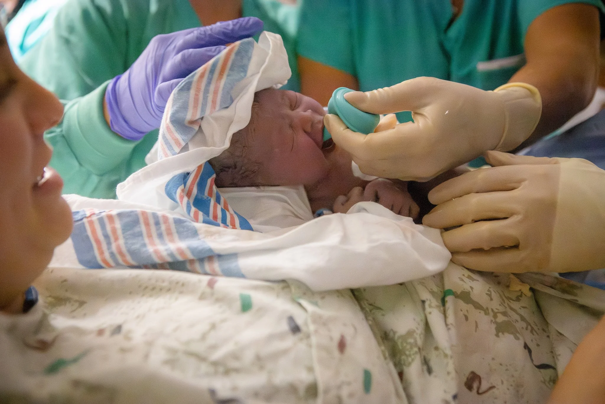A newborn baby being gently fed with a bottle while lying on a hospital bed, surrounded by medical staff wearing scrubs and gloves.