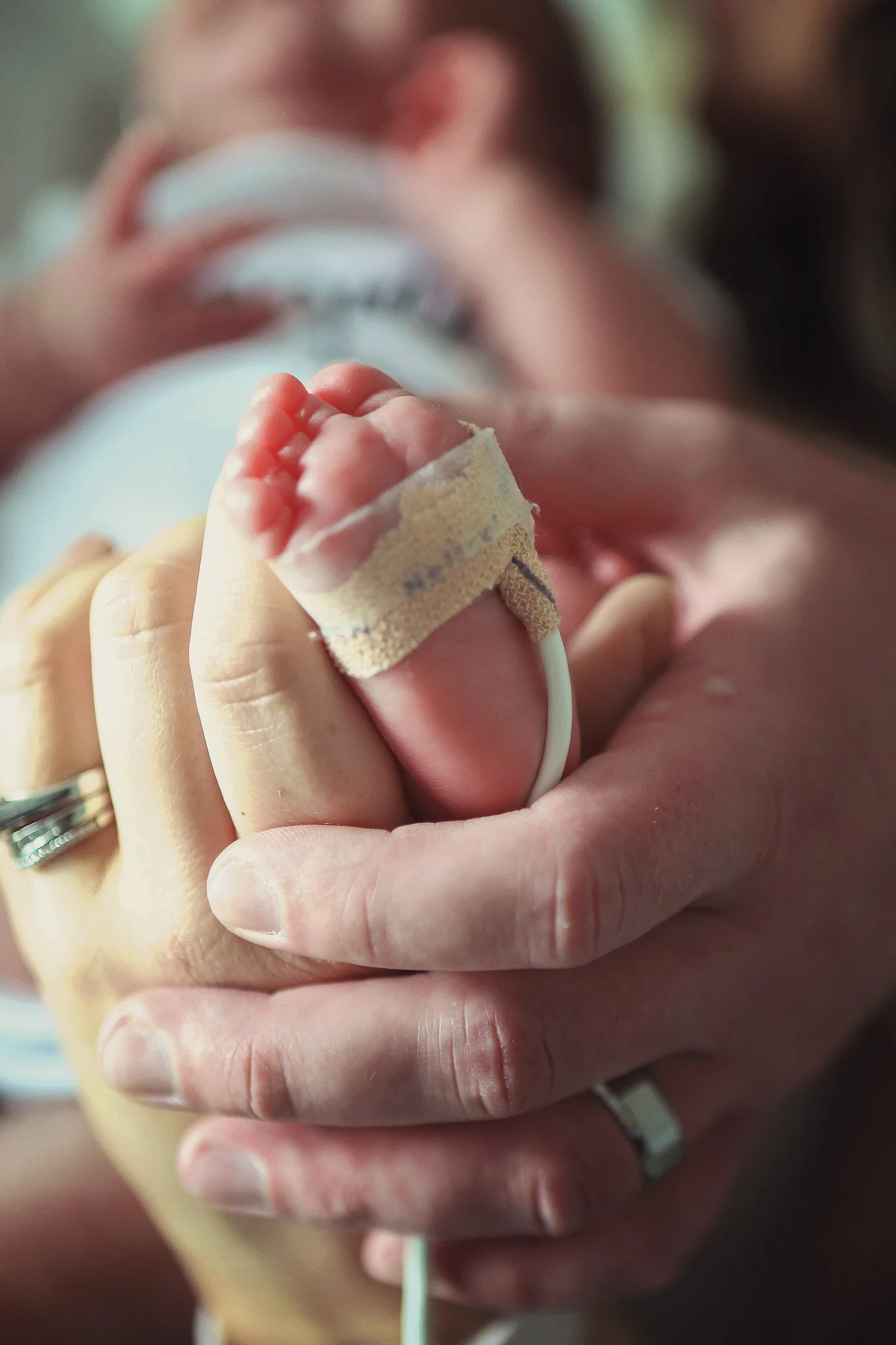 Close-up of a newborn baby’s foot with medical tape and a wire, held by an adult hand in a hospital or birthing center.