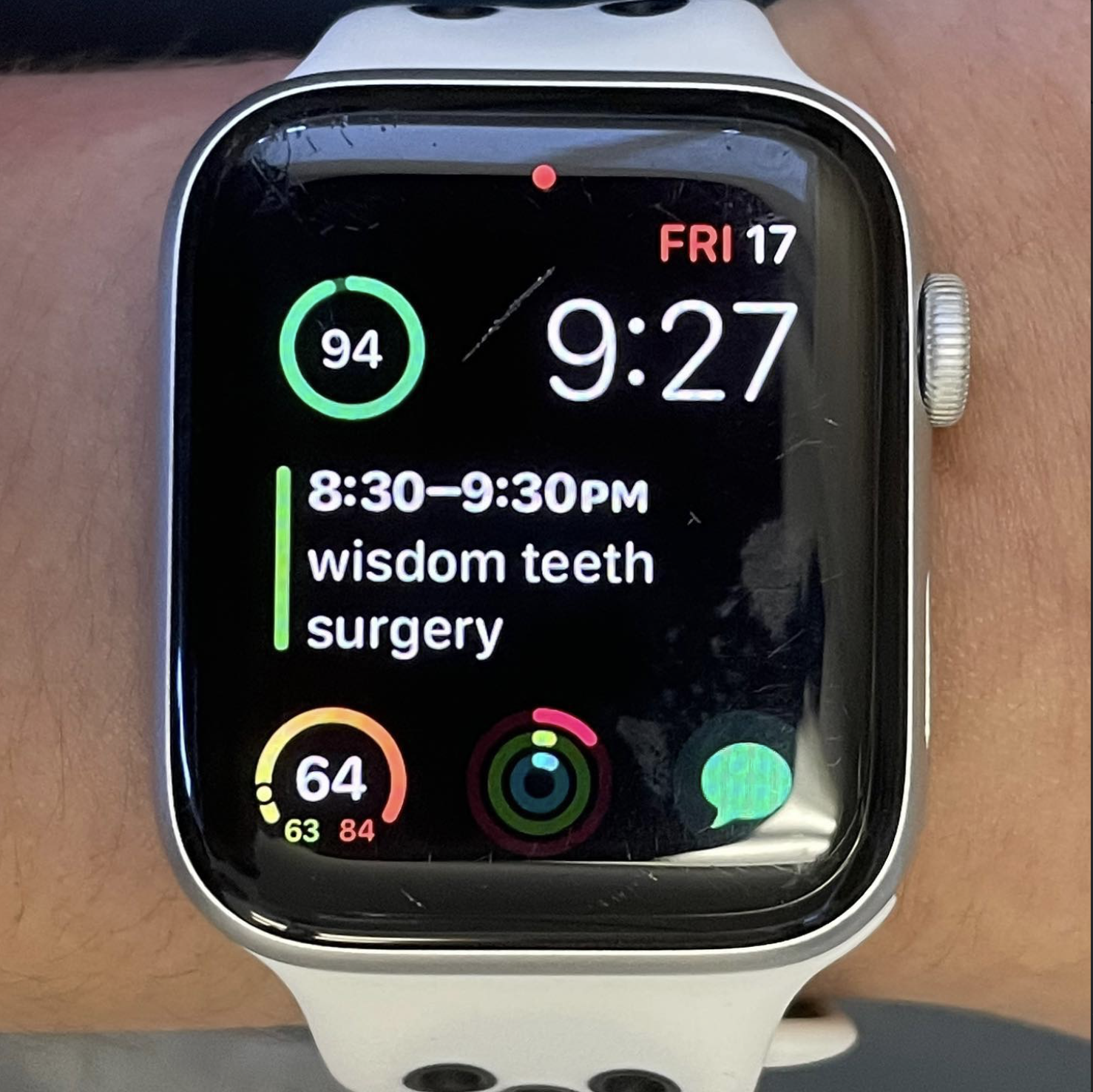 Smartwatch showing a wisdom teeth surgery scheduled from 8:30 to 9:30 PM