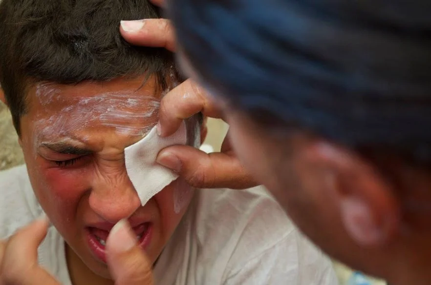Palestinian teenage boy injured by tear gas canister fired by the Israeli Defense Force at Al Aqsa mosque in June 2014. | Photo by Rasha Abousalem