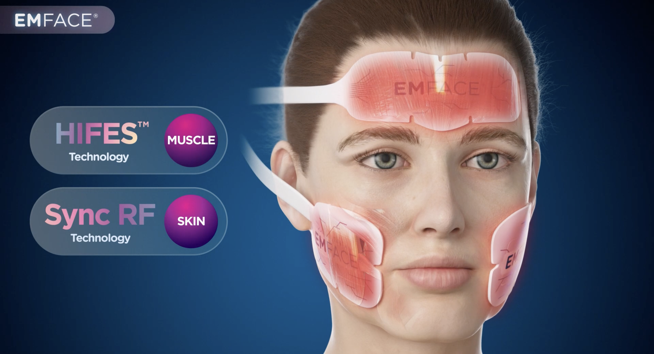 Diagram of EMFACE® dual-action technology combining Synchronized Radiofrequency for skin collagen and HIFES™ for facial muscle toning.