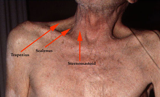 Why your neck won’t release (Hint: It’s your breathing)
