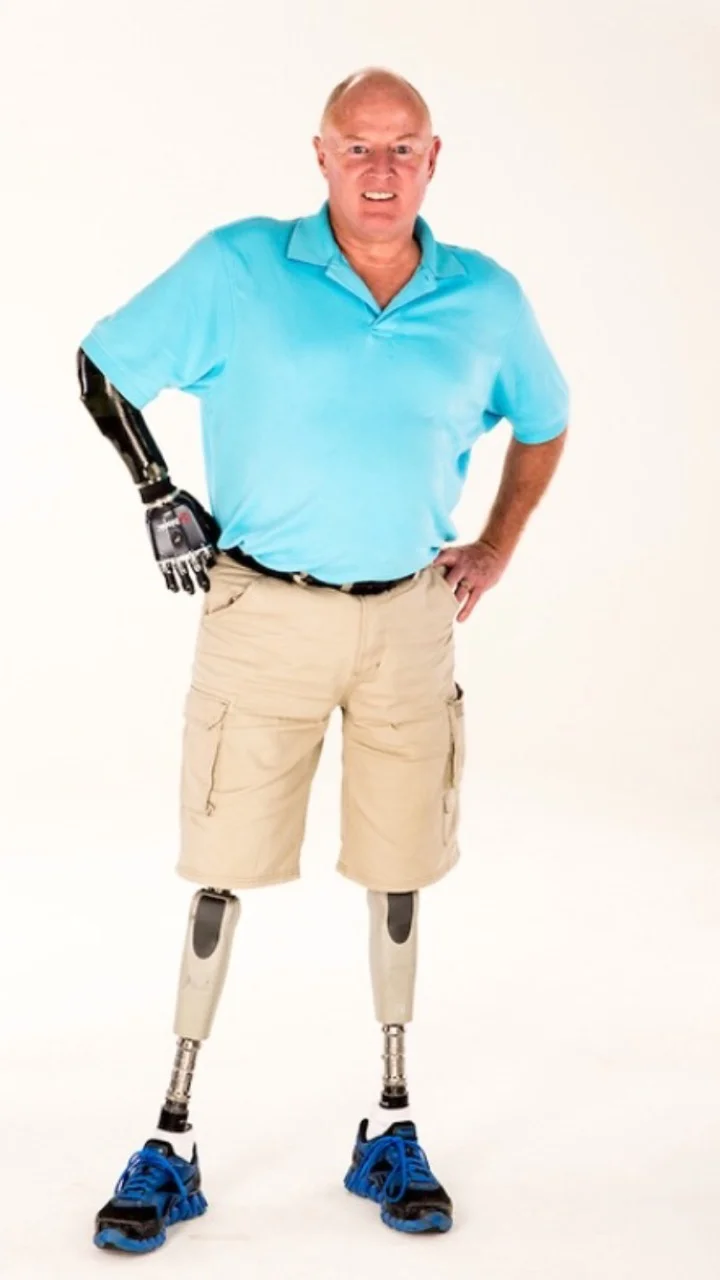 “As a trilateral amputee I understand the struggle of limb loss, and I’m here to offer support in your journey to recovery” - Ray Styles