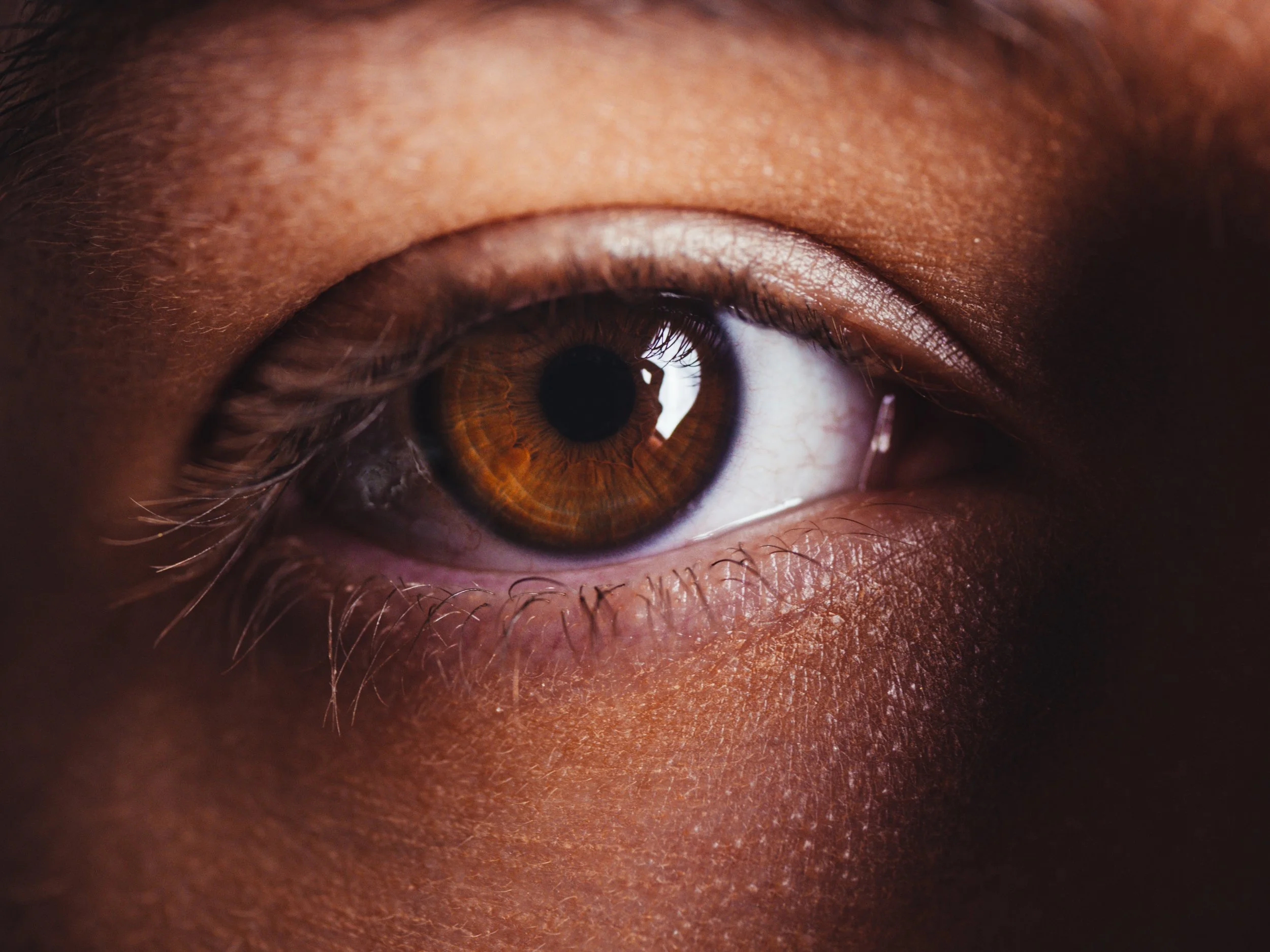 Pink Eye in Kids: 3 Types of Conjunctivitis Parents Should Look Out For