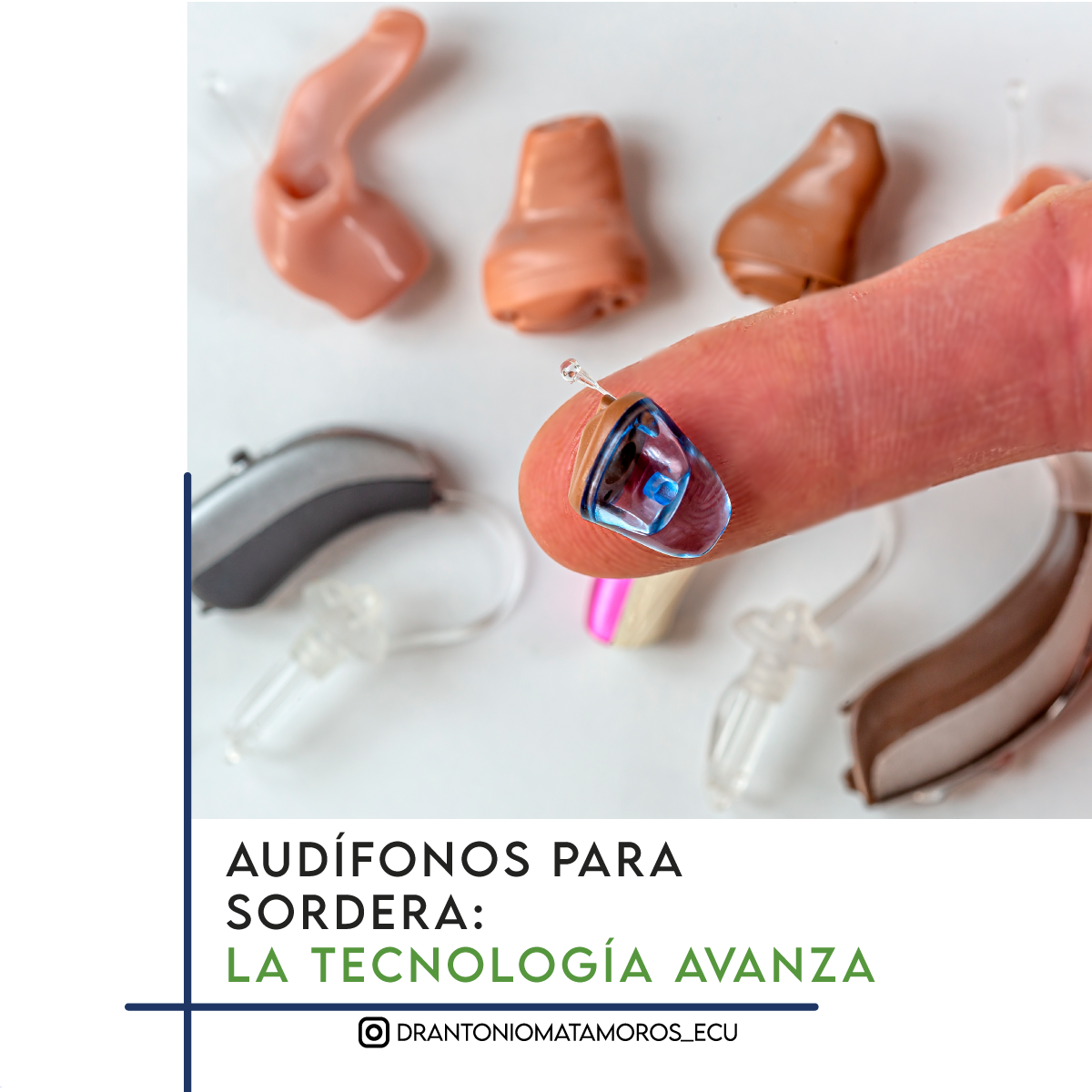 AUDÍFONOS: LA TECNOLOGÍA AVANZA