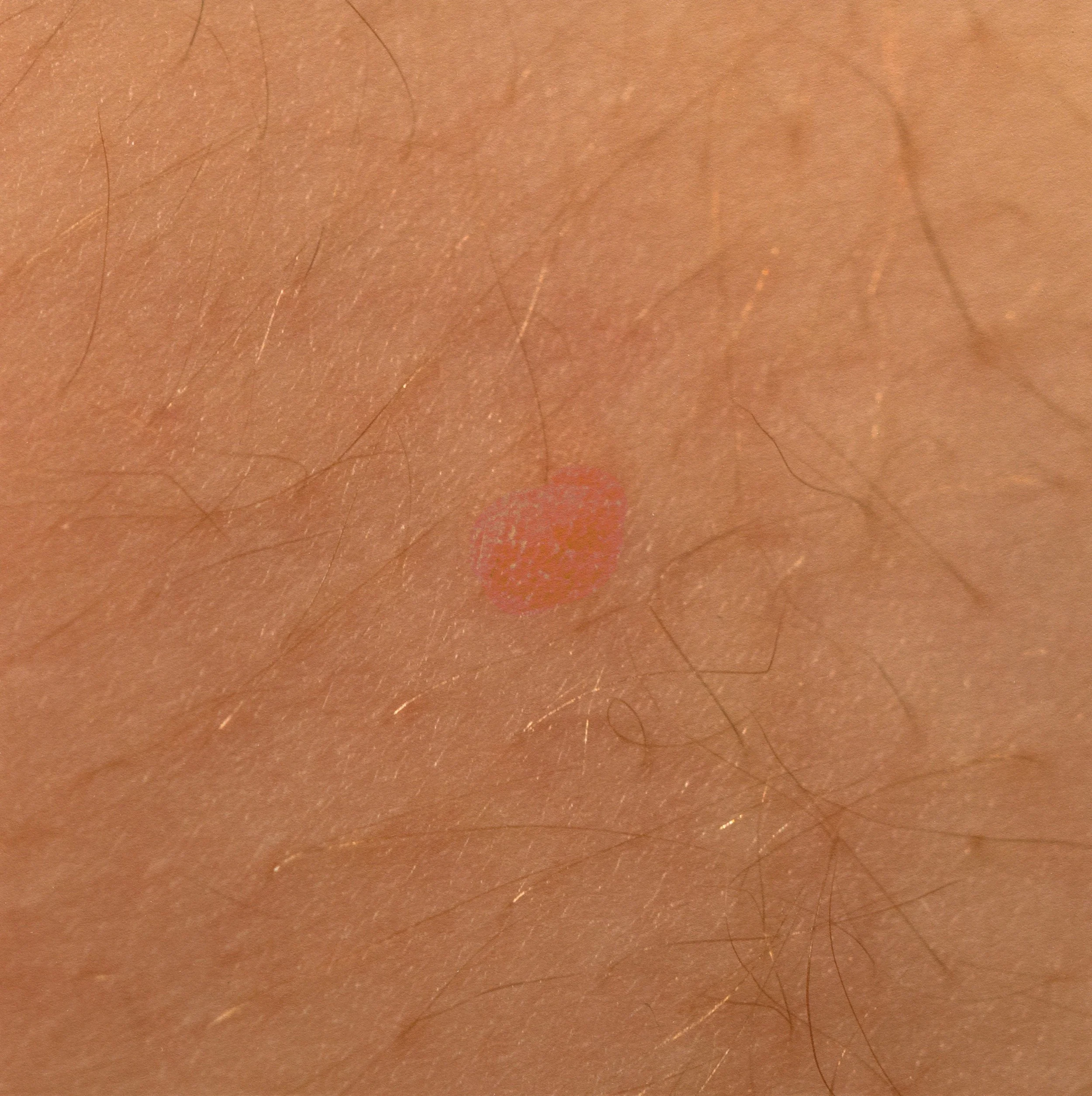 2. The only part of my midsection.jpg