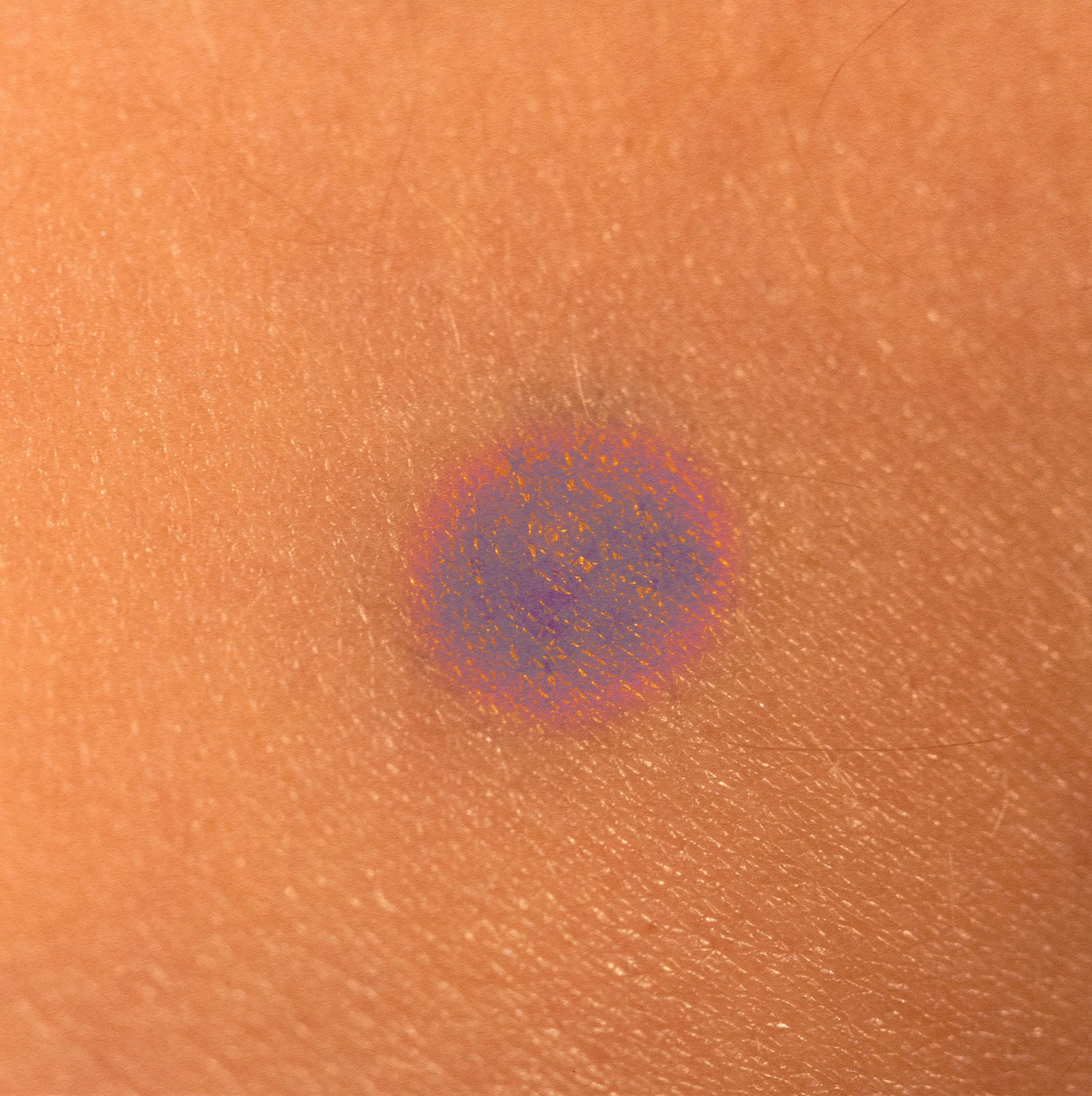 5. My favorite birthmark.jpg