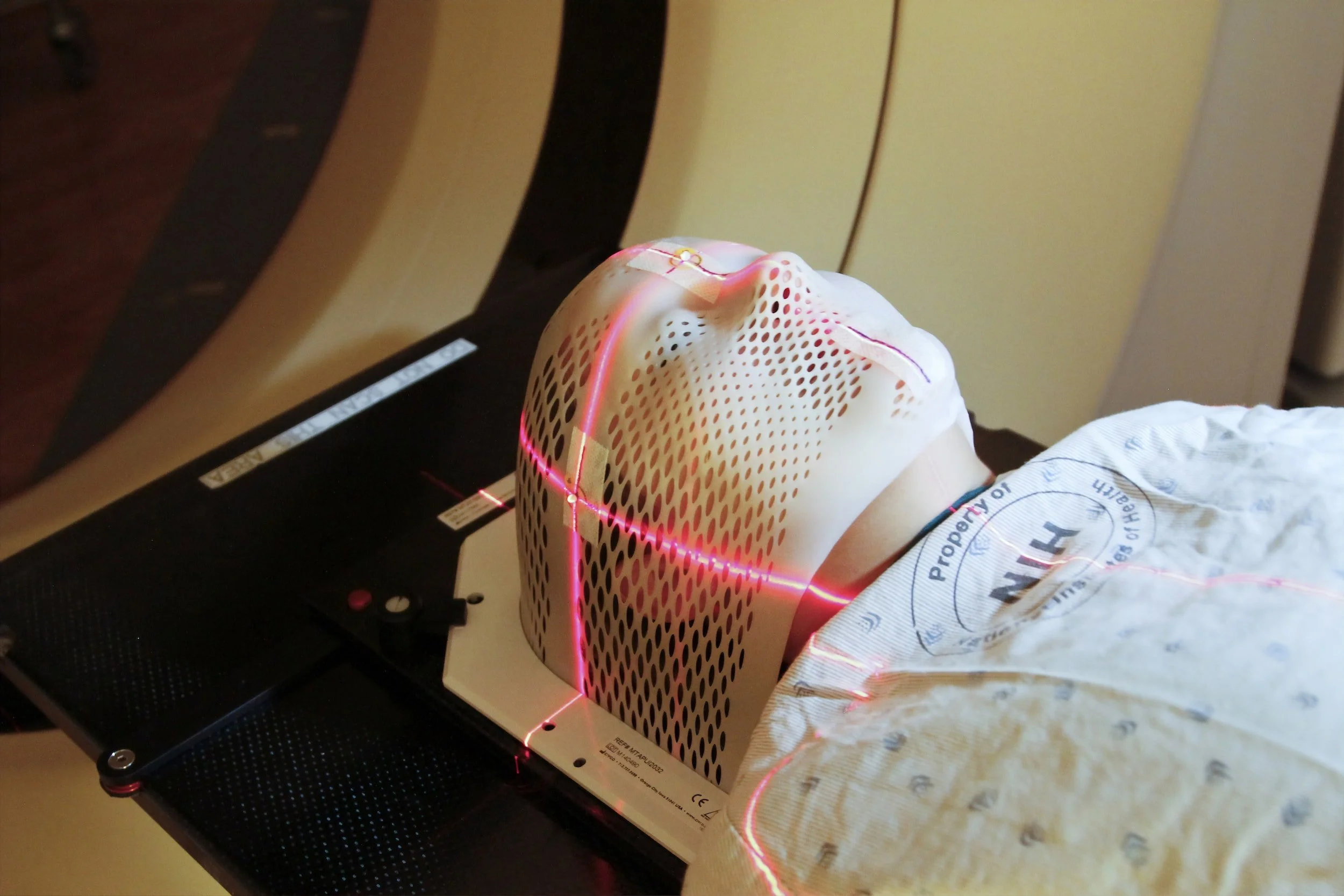 How to File a Lawsuit for Traumatic Brain Injury