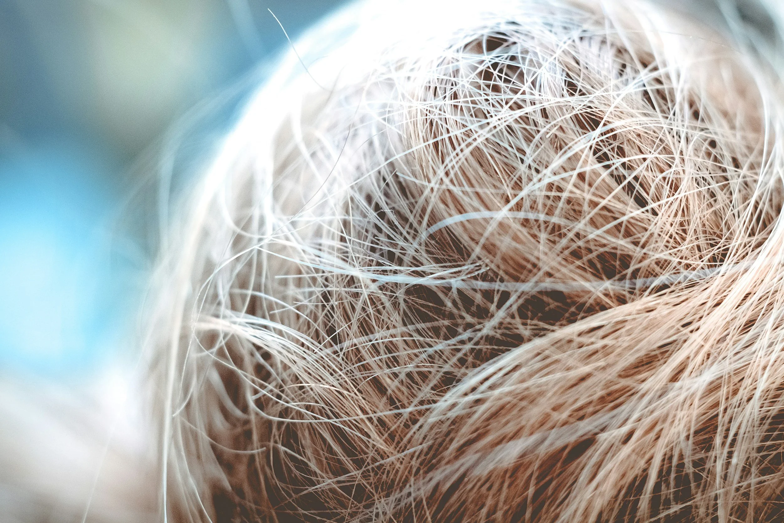 What Factors to Consider For Choosing the Best Hair Transplant Clinic in Toronto?