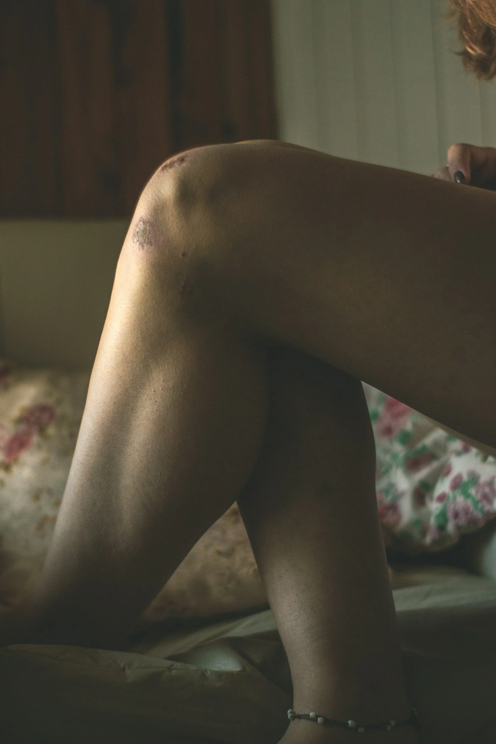 Some Injuries that are Seen in the Most Severe Truck Accidents