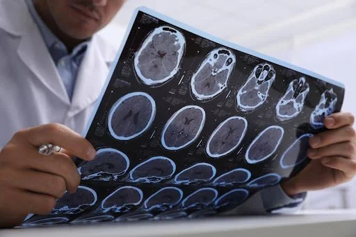 How to Determine If a Car Accident Victim Has Sustained a Concussion