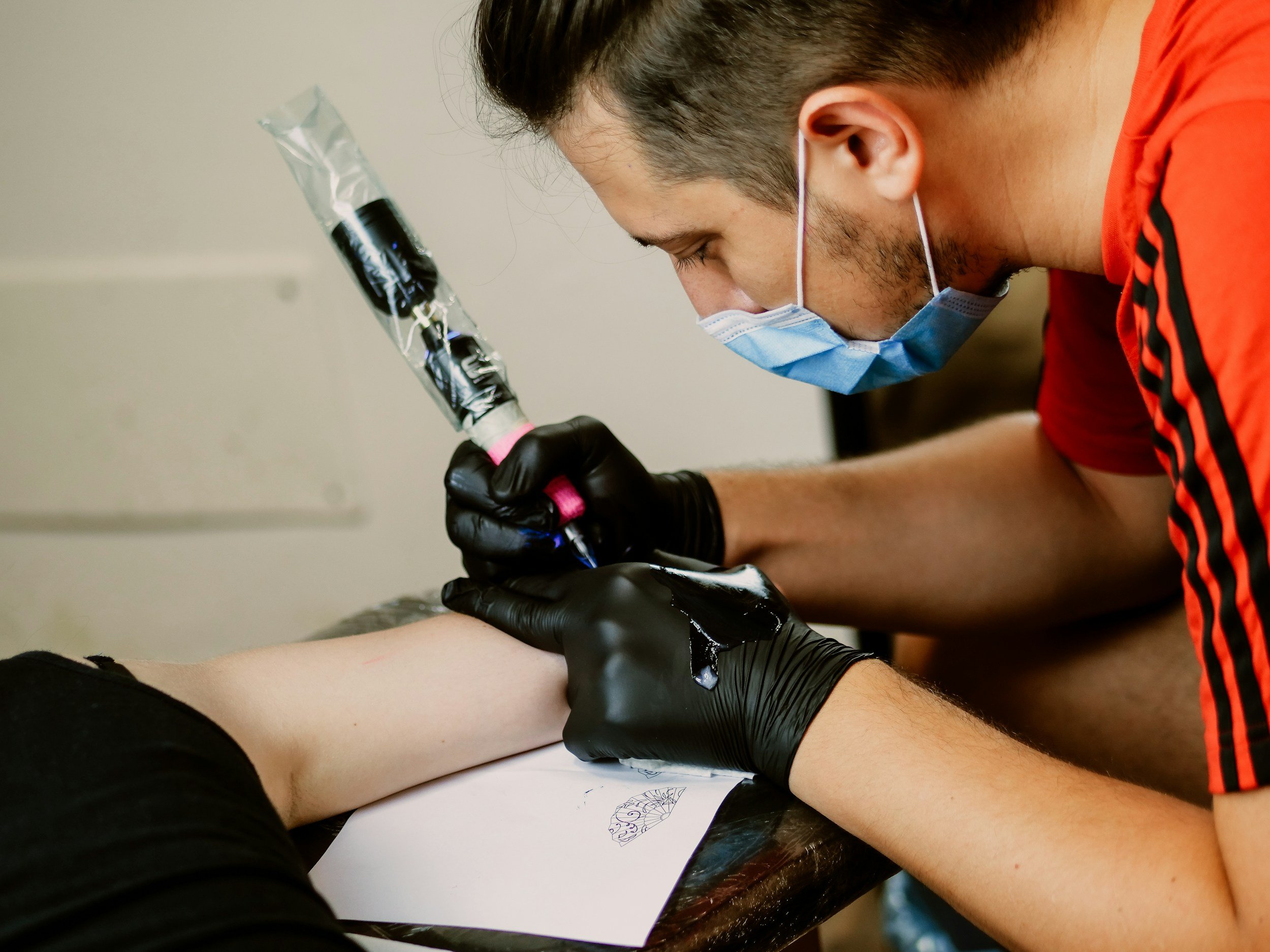 Laser Tattoo Removal in Santa Barbara: What to Know Before You Begin