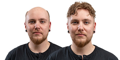 Premium Hair Systems and the Future of Men’s Grooming 