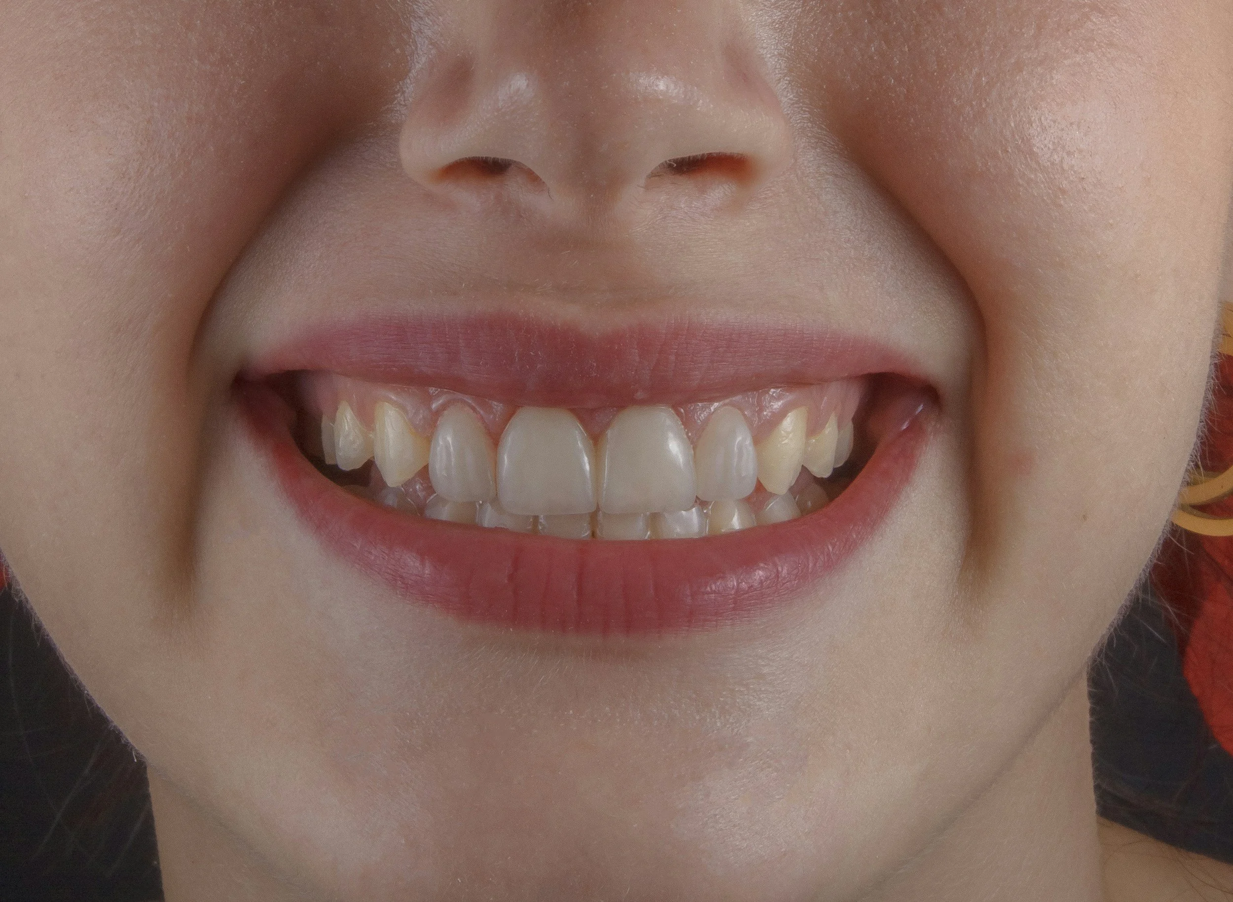 The Beauty Beneath the Smile: Why Australian Fashion Culture Is Taking a More Holistic View of Oral Health