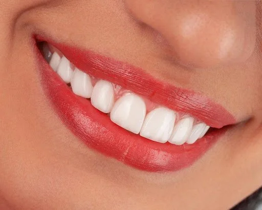 Achieving the Perfect Smile: Beyond Simple Dental Care