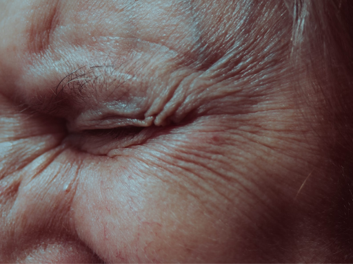 The Ultimate Guide to Preventing and Treating Facial Lines