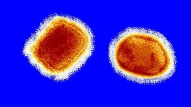 First monkeypox case detected in Mozambique