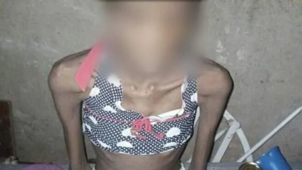 Caged girl rescued by police in Nigeria 