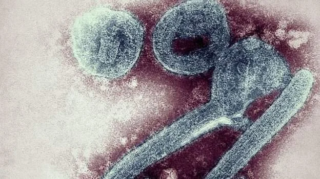 Guinea confirms West Africa's first Marburg virus case 