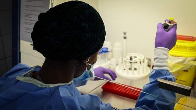 Outbreak as meningitis kills 120 in DR Congo 