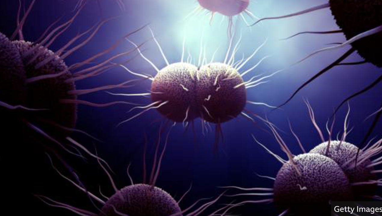 New gonorrhoea strain detected in Nairobi