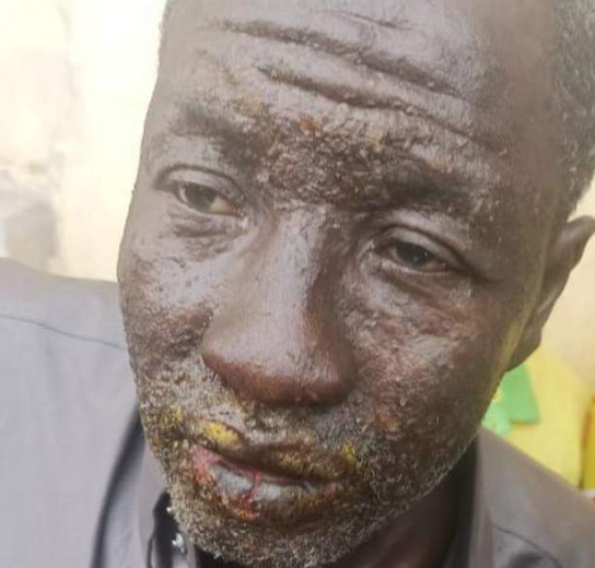 Dozens of fishermen suffer unidentified burns at sea