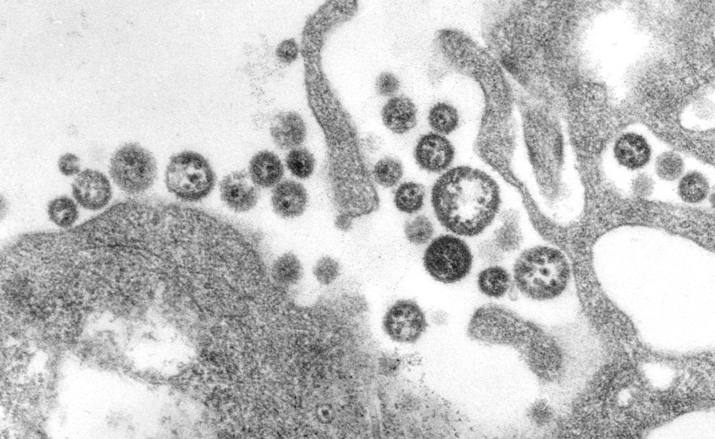 Nigeria Records 118 Lassa Fever Deaths, 645 Cases in 33 States