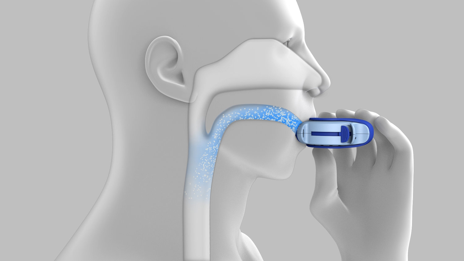 Medical Device Animation — Chris Hayden Medical Device Animation — Chris Hayden