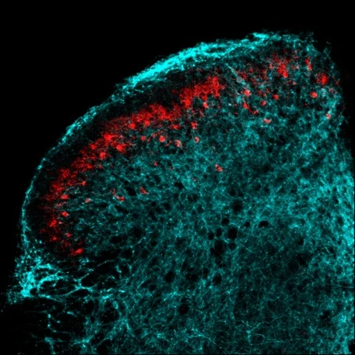 PKCgamma%2BNK1R%2Bspinal%2Bneurons.jpg