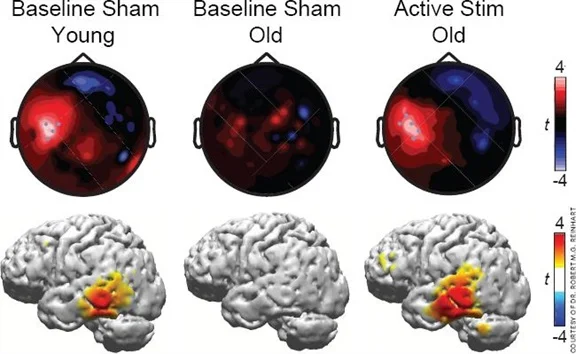 Prof. Bikson quoted on HD-tACS for memory in Neurology Today