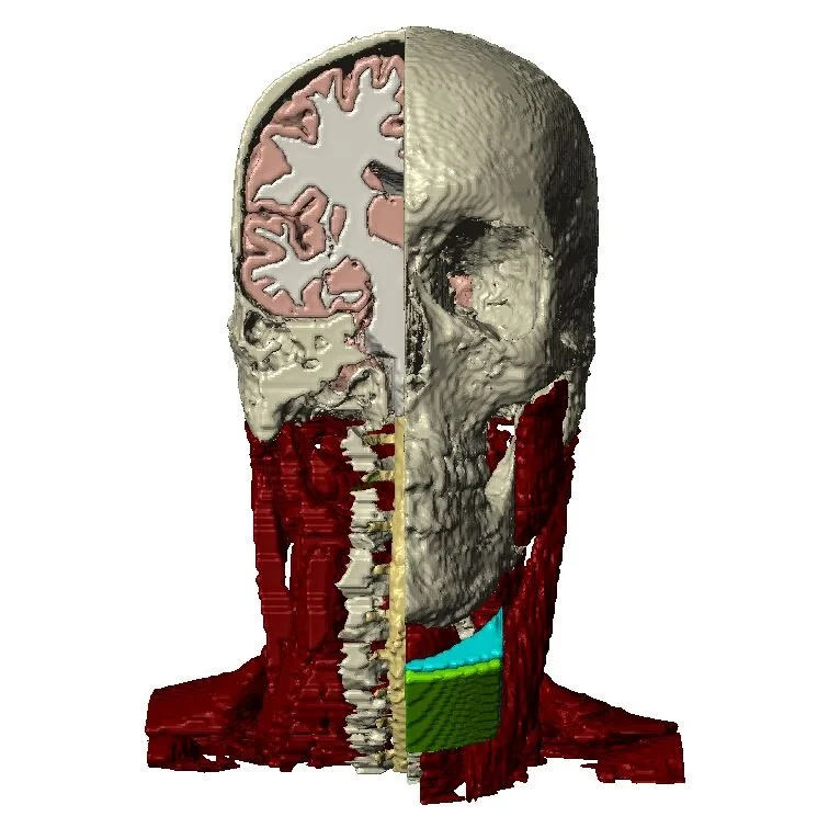 CCNY Neural Engineering supports NYC Neuromodulation 2020 conference