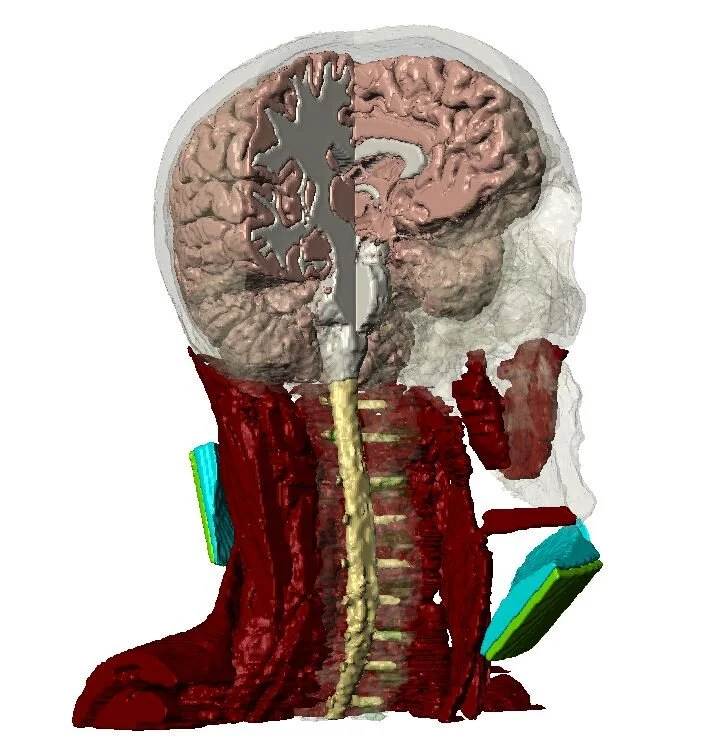 Bikson co-chairs and speaks at Neuromodulation Engineering Principles