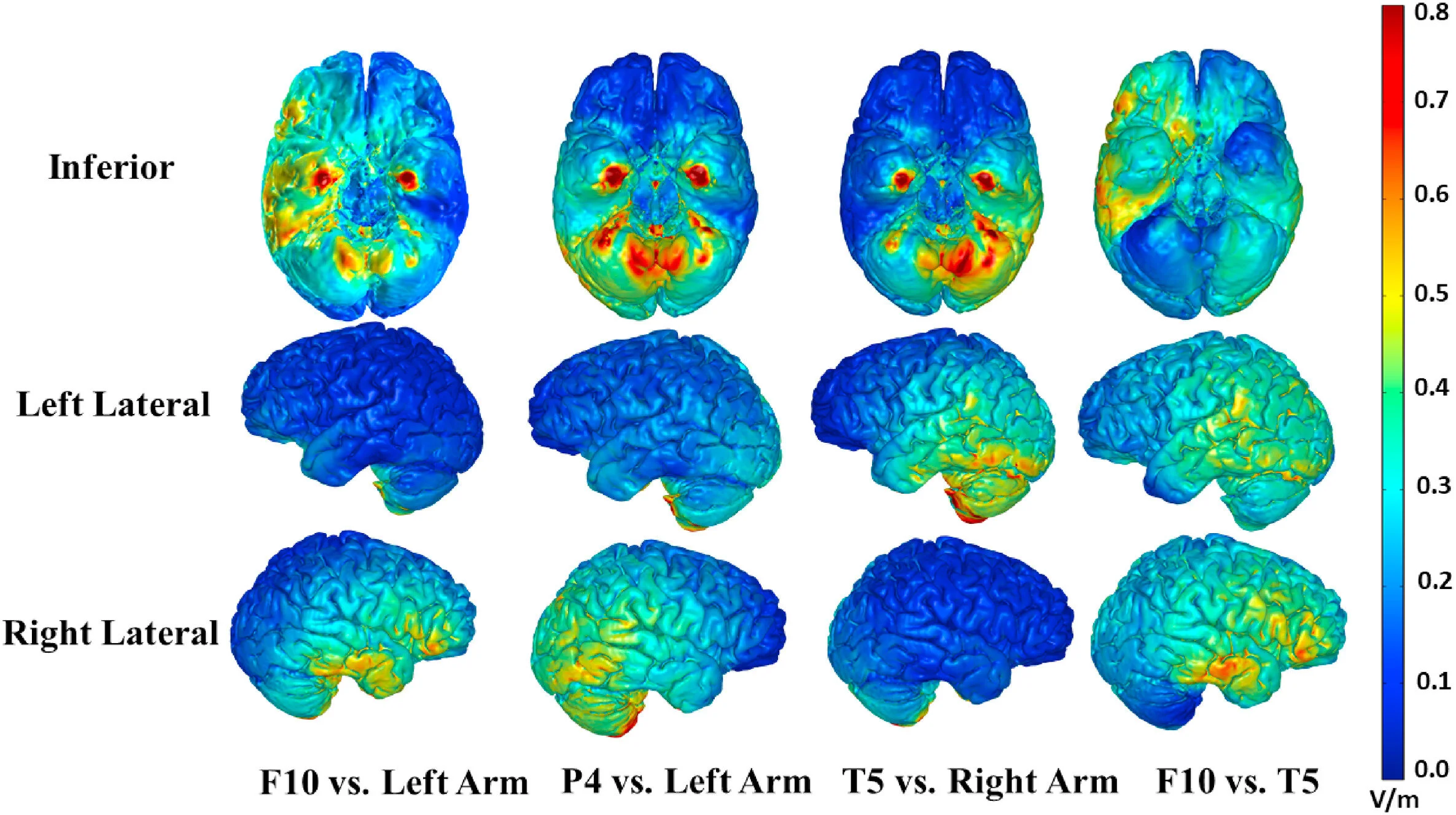 New Paper: Investigating the brain regions involved in tDCS-Enhanced category learning using finite element modeling