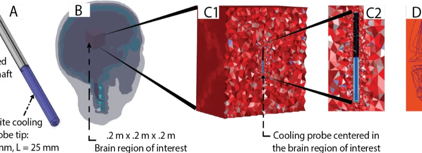 New Pub: Finite Element Method Model Mapping Focal Intracranial Cooling