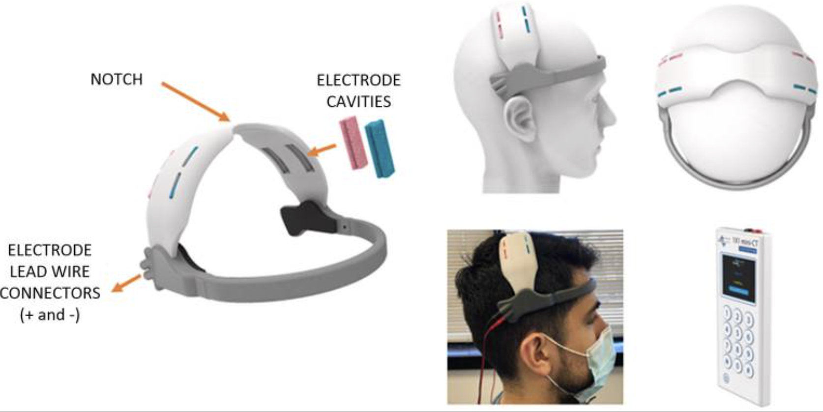 New publication:  Home-Based HD-tDCS for Bilateral Motor Cortex Modulation in Pain