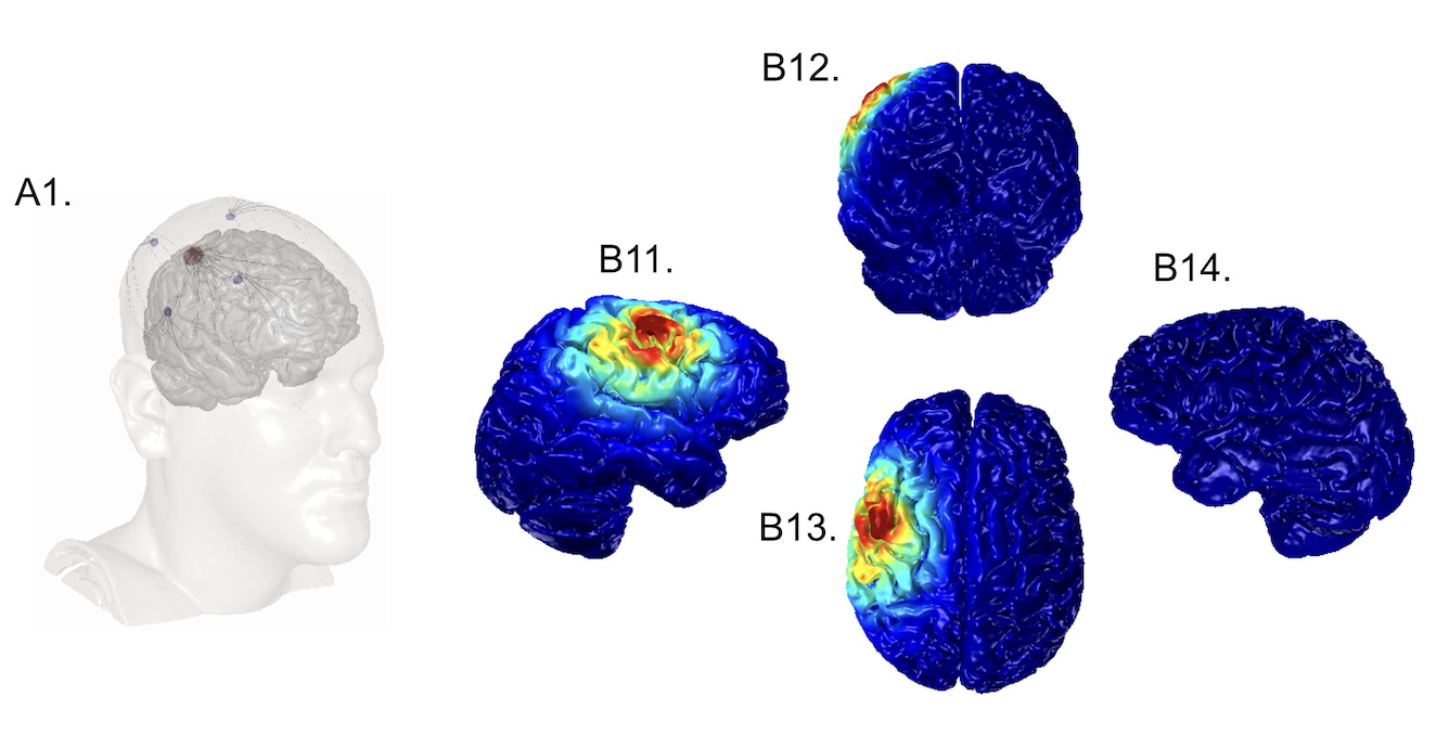 New paper:  Computational Models of HD-ECT 
