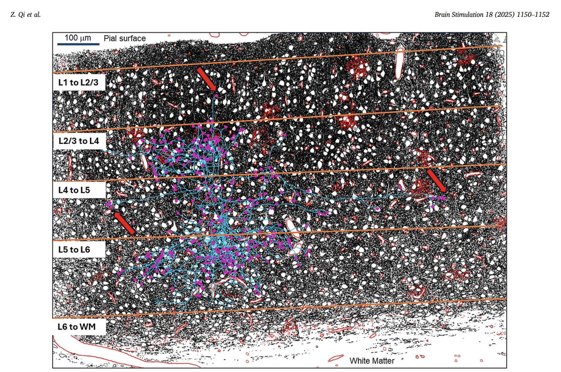 New Letter: Importance of considering microscopic structures in modeling brain stimulation