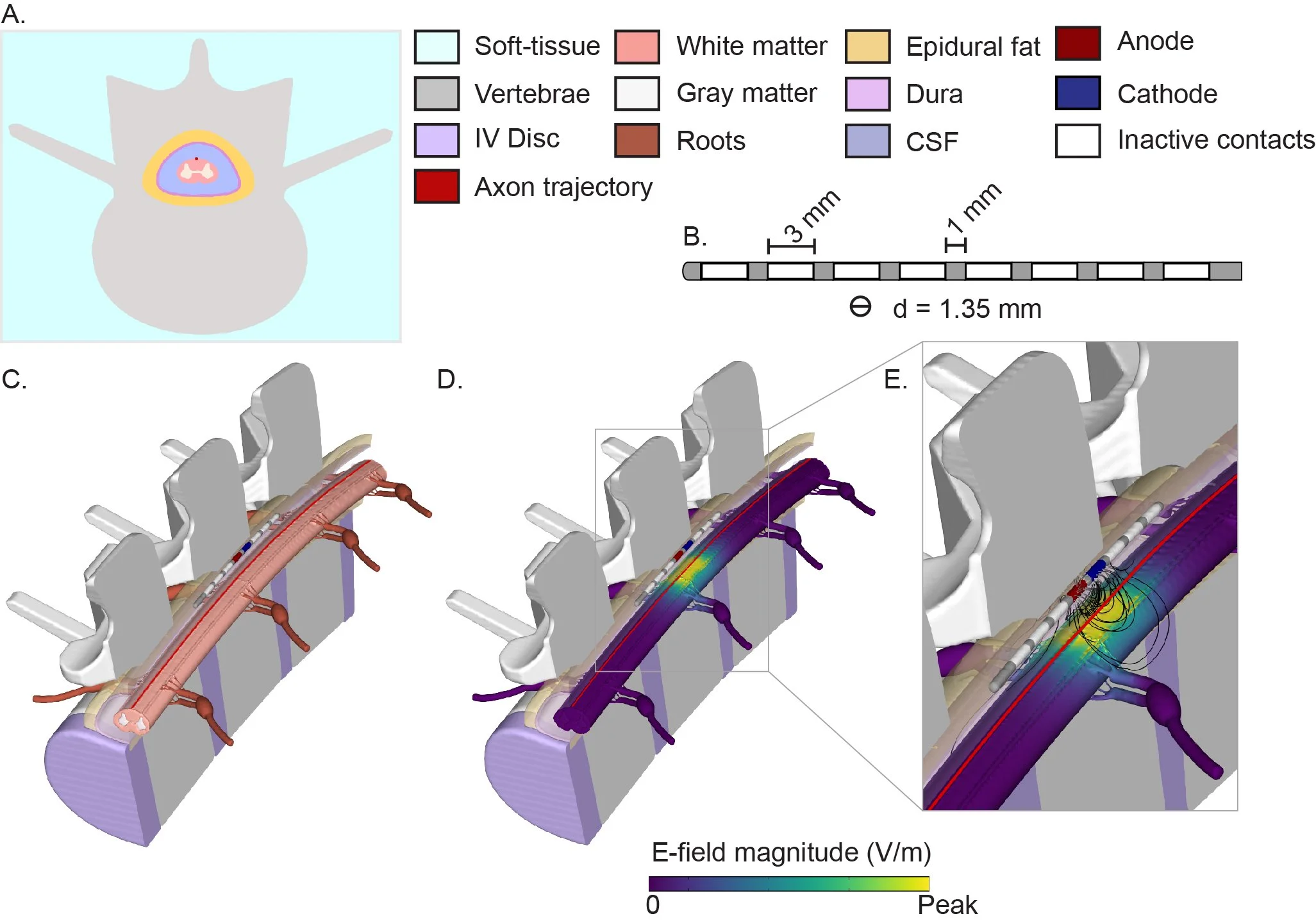 New Paper: Role of frequency-dependent and capacitive tissue properties in spinal cord stimulation models