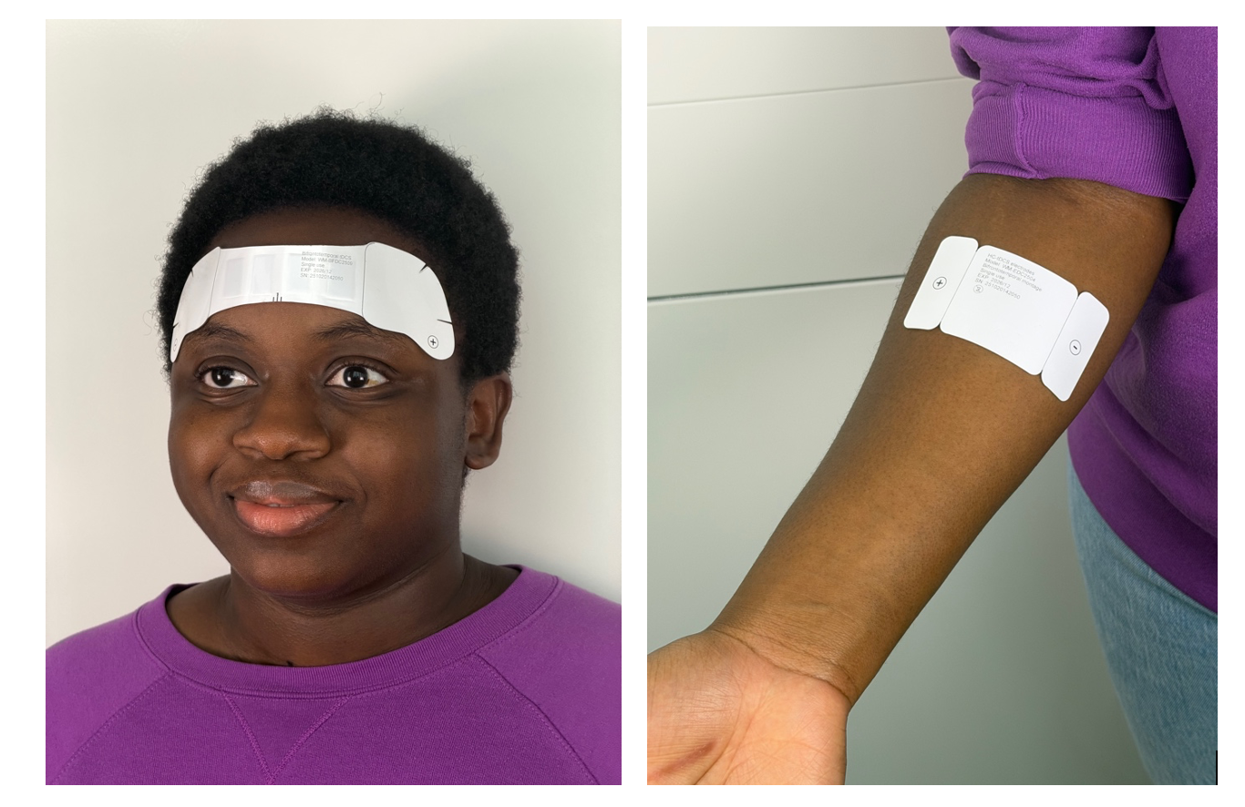 Press Release on Wearable Disposable Electrotherapy 