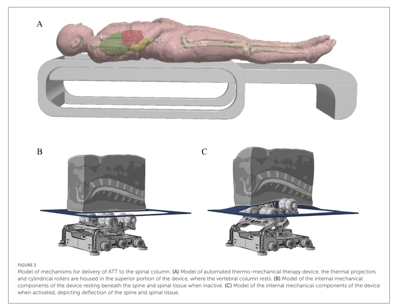 New paper:  Robot bed thermo-mechanical therapy for back pain