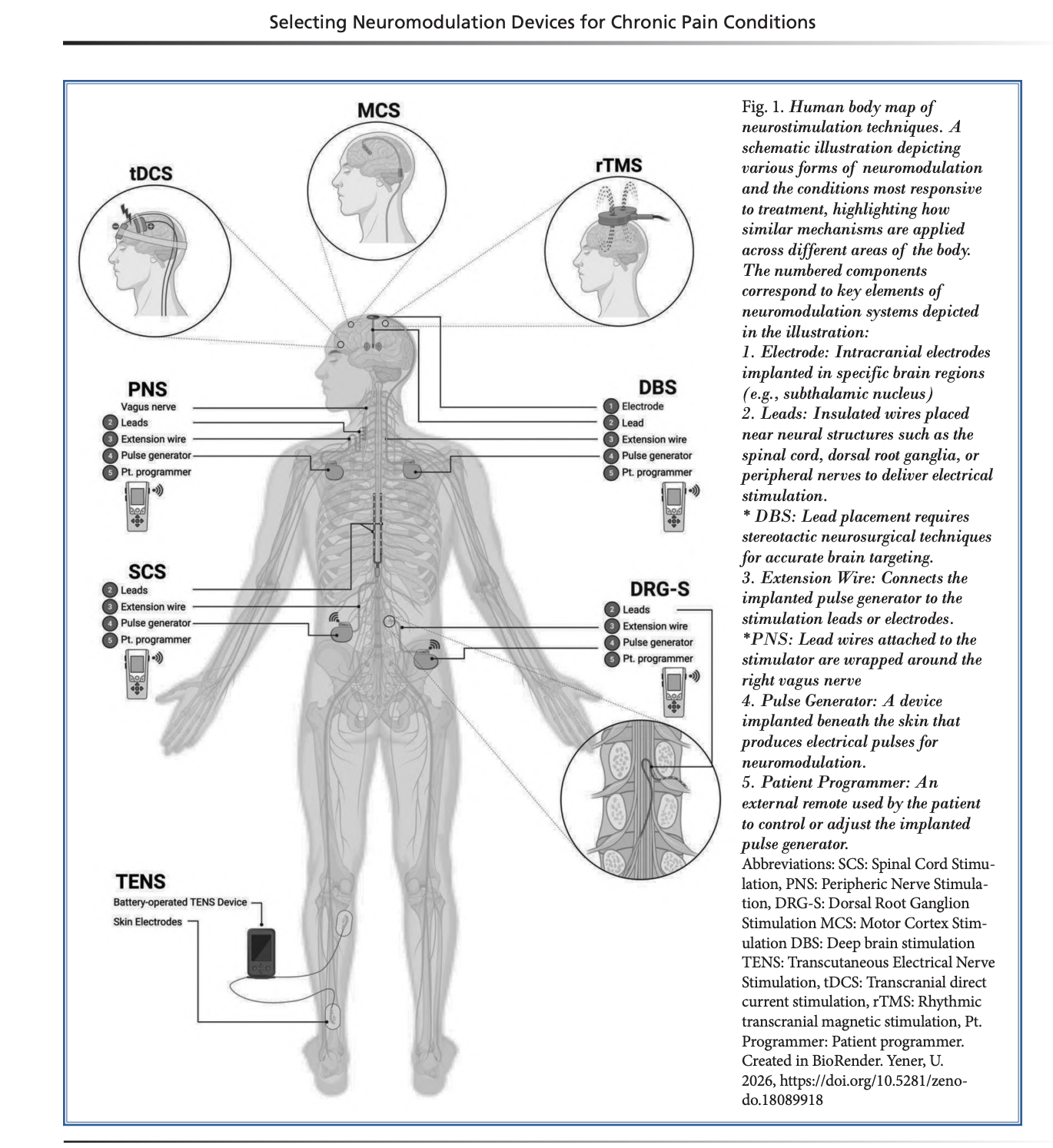 New paper:  Selecting Neuromodulation Devices For Chronic Pain Conditions