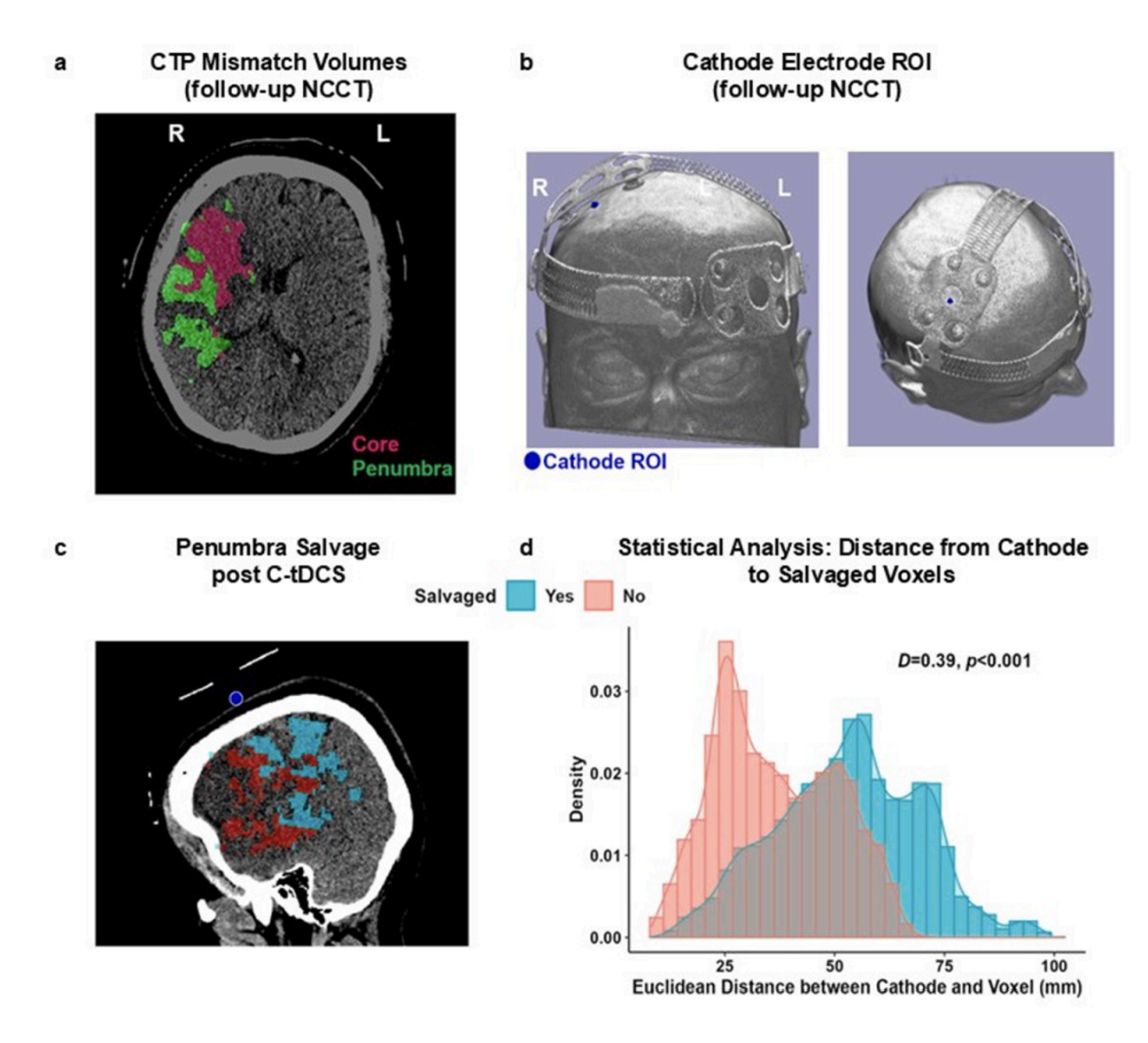 New paper:  tDCS in hyperacute stroke
