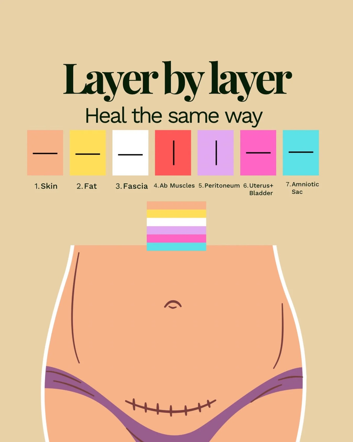 #csectionawarenessmonth reminder.
There is no such thing as &ldquo;less than&rdquo; when it comes to how you gave birth. And there should be no &ldquo;less time&rdquo; when it comes to how you heal.