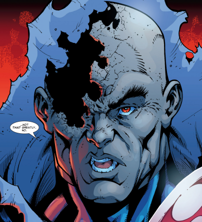 I’d say dead, but he never had much brains to begin with.