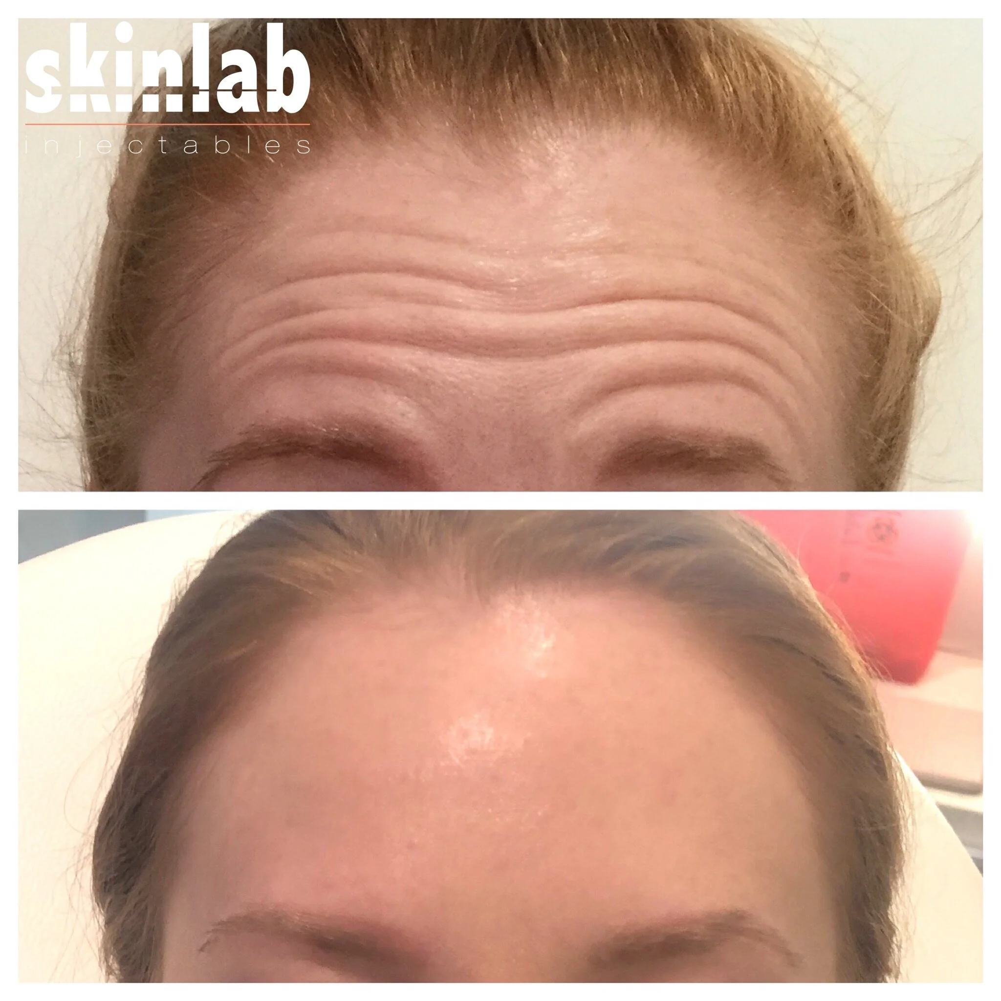 Our Work — Skinlab Injectables
