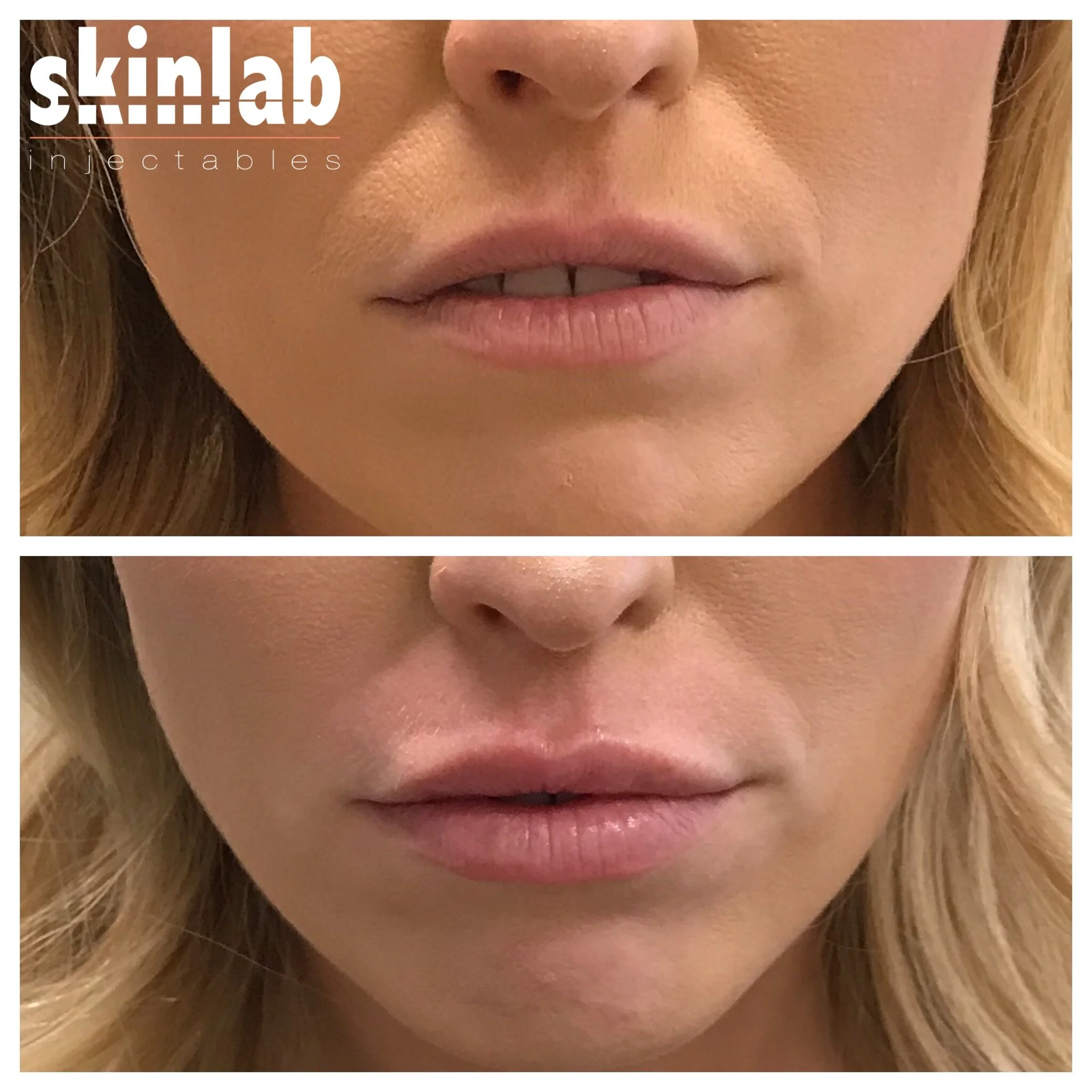 Our Work — Skinlab Injectables