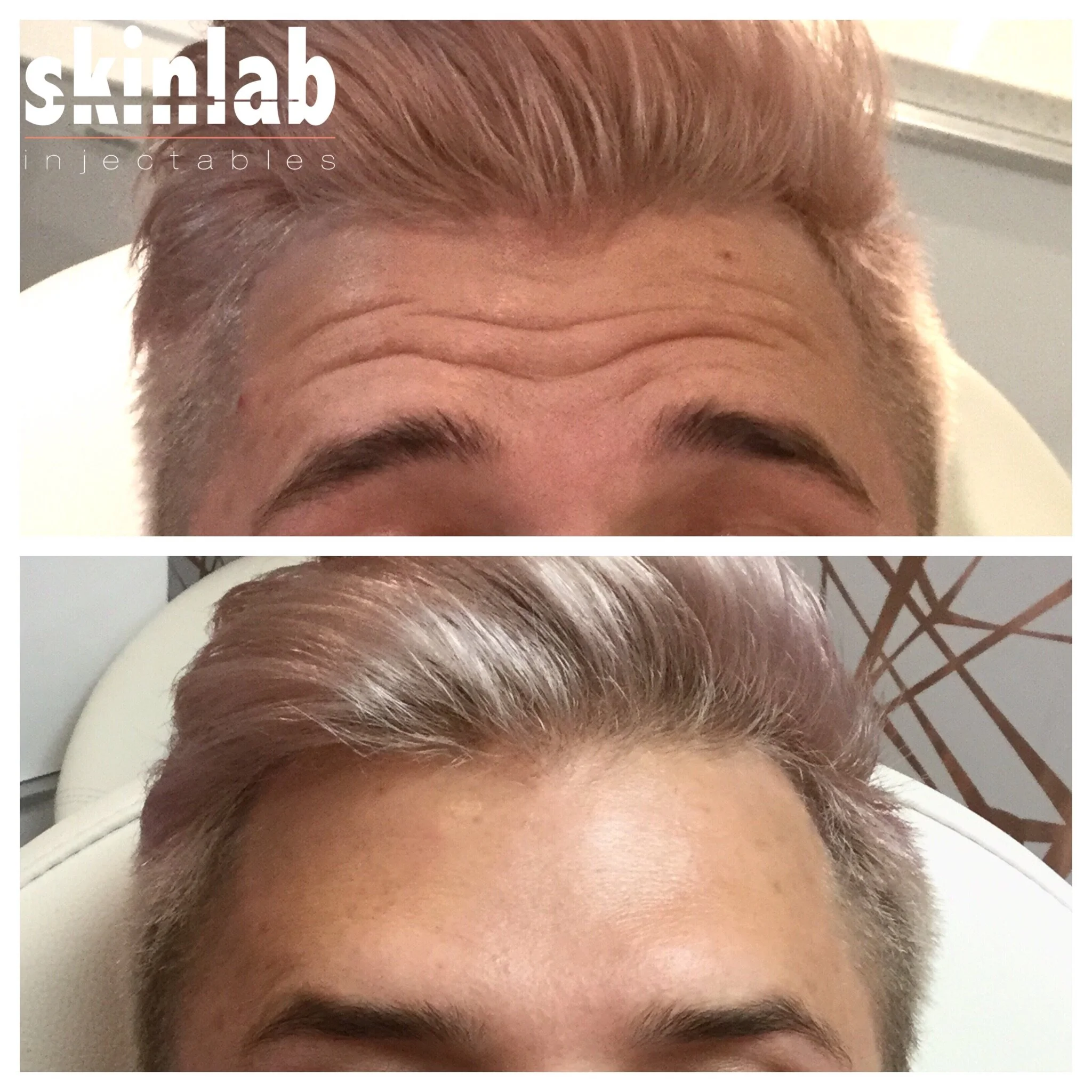 Our Work — Skinlab Injectables